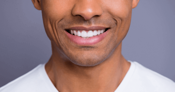 Man with dental implants smiling into the camera