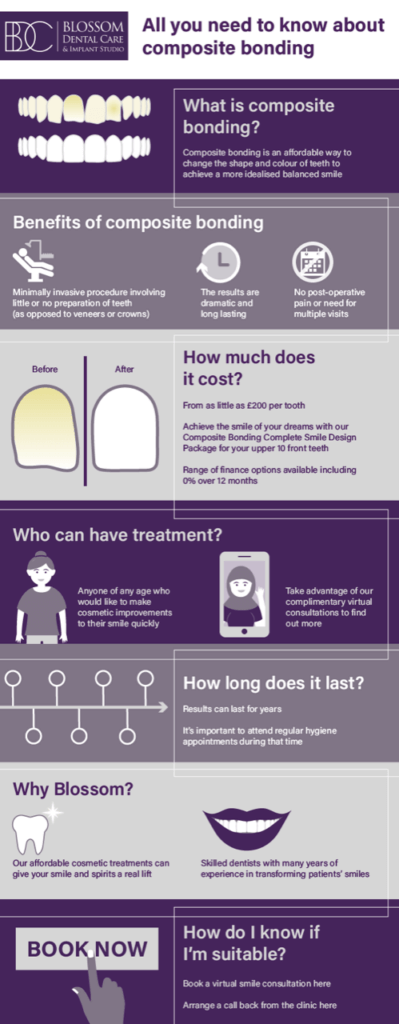 Infographic about the benefits of composite bonding in York