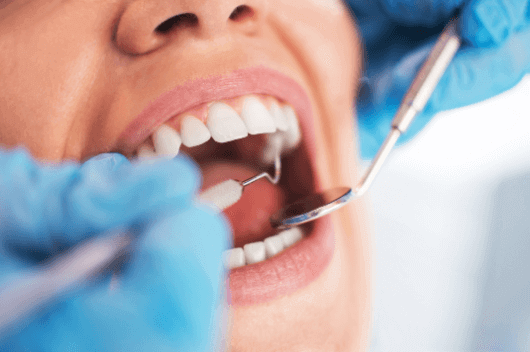 Oral Health During Brace Treatment