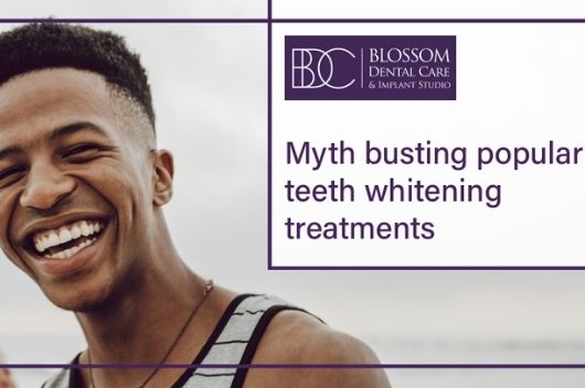 Top Five Myths about Teeth Whitening