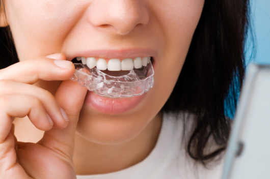 invisalign york dental