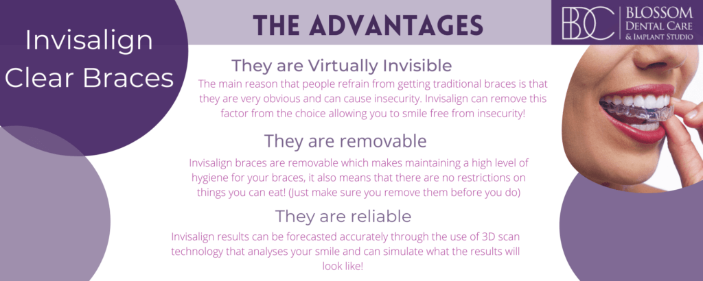 infographic about Invisalign in York