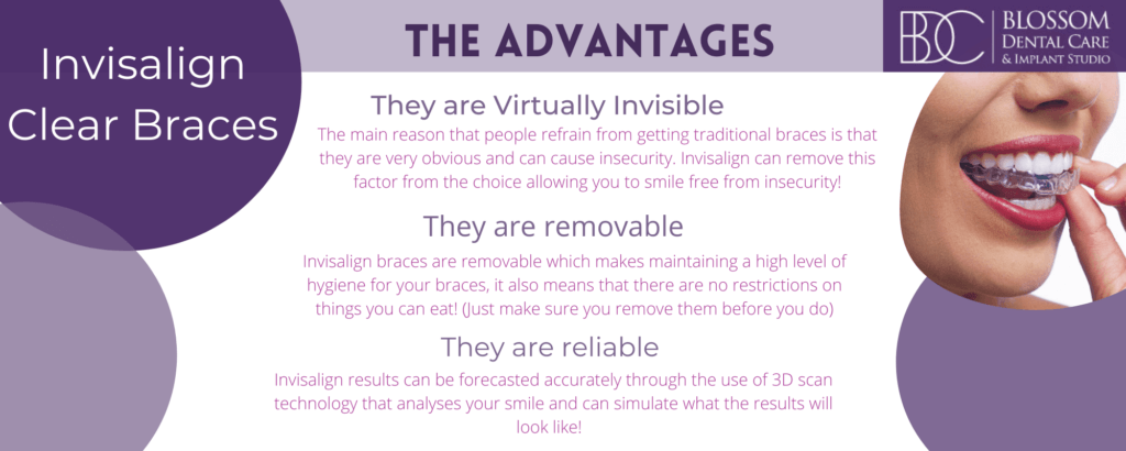 Invisalign Clear Braces Infographics