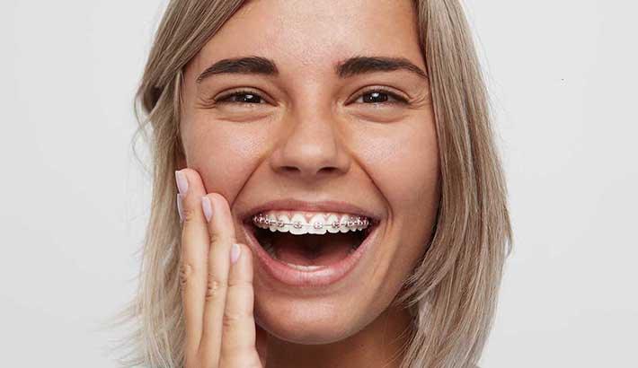adult braces