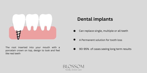 Dental Implants Infrographic