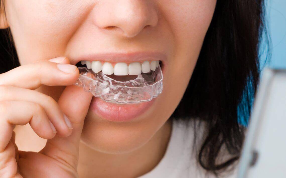 woman putting in her Invisalign braces in York.